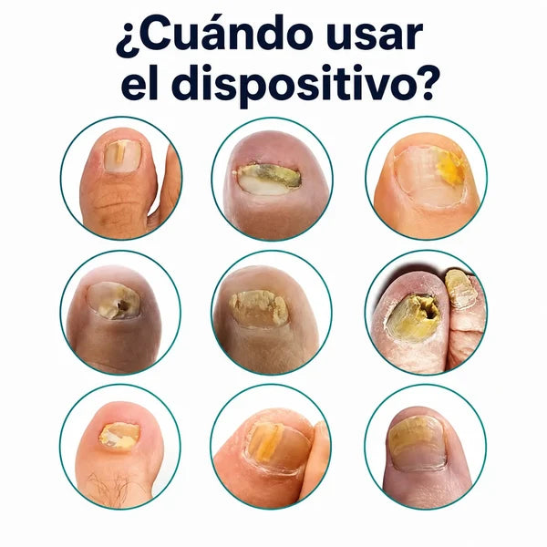 Lampara Laser Para Uñas (PRECIO SOLO POR HOY)