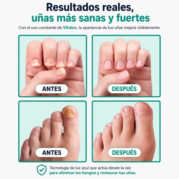Lampara Laser Para Uñas (PRECIO SOLO POR HOY)